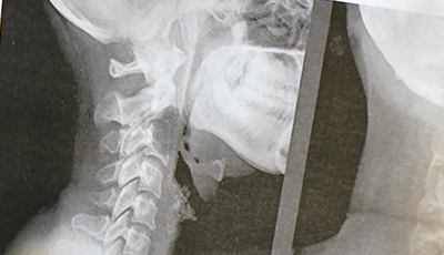 centrodediagnosticoradiologico_rayosxgeneral