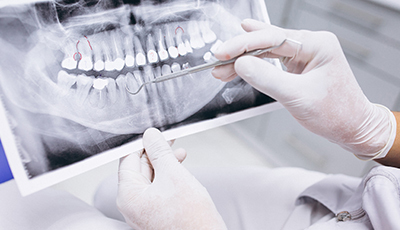 centrodediagnosticoradiologico_rayosxdental